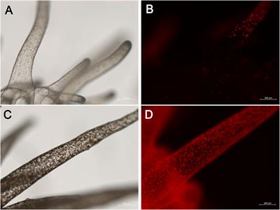 Bacterial microbiome variation across symbiotic states and clonal lines in a cnidarian model